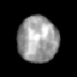 Real crop: Lung epithelial